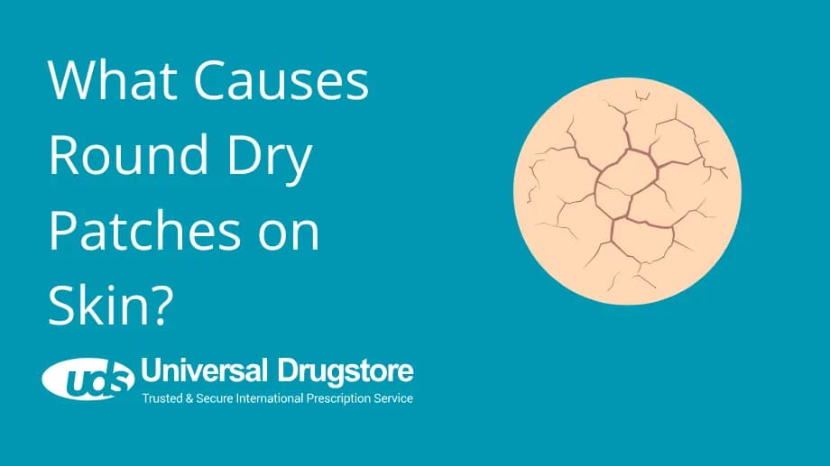 What Causes Round Dry Patches on Skin?